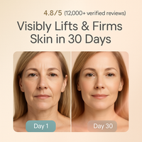 LumeraGlow– RF Facial Tightening Wand